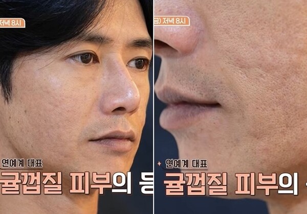 원조 꽃미남 <b>클릭비 오종혁</b>의 몰락 "식도 녹고 온몸에 수포"