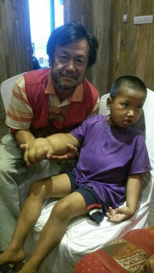 네팔 어린이 풀마야 2차 수술을 위해 5월 31일 입국
