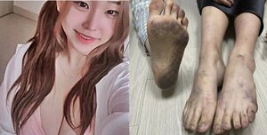 BJ 요원, 이태원 참사 현장 피해 인증