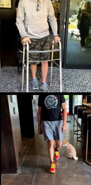 제설차량 중상 제레미 레너 재활 '호크아이의 기적'