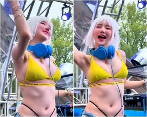 DJ소다, 탈색 사고 후 부분 삭발-가발쓰고 공연