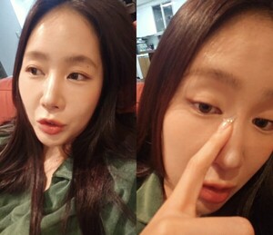 씨스타 소유, 10kg 감량 후 성형했냐는 반응 기분 좋아