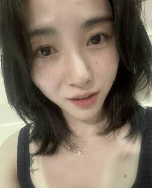 AOA 출신 권민아, 피부과 상담실장 전향? 퇴사