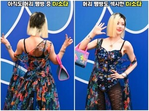 DJ소다, 더 이상 숨지 않아 머리 땜빵 중 정면 돌파”
