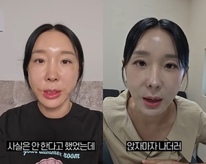 이지혜, 45살 되고 리프팅, 광고 아닌 내돈내산